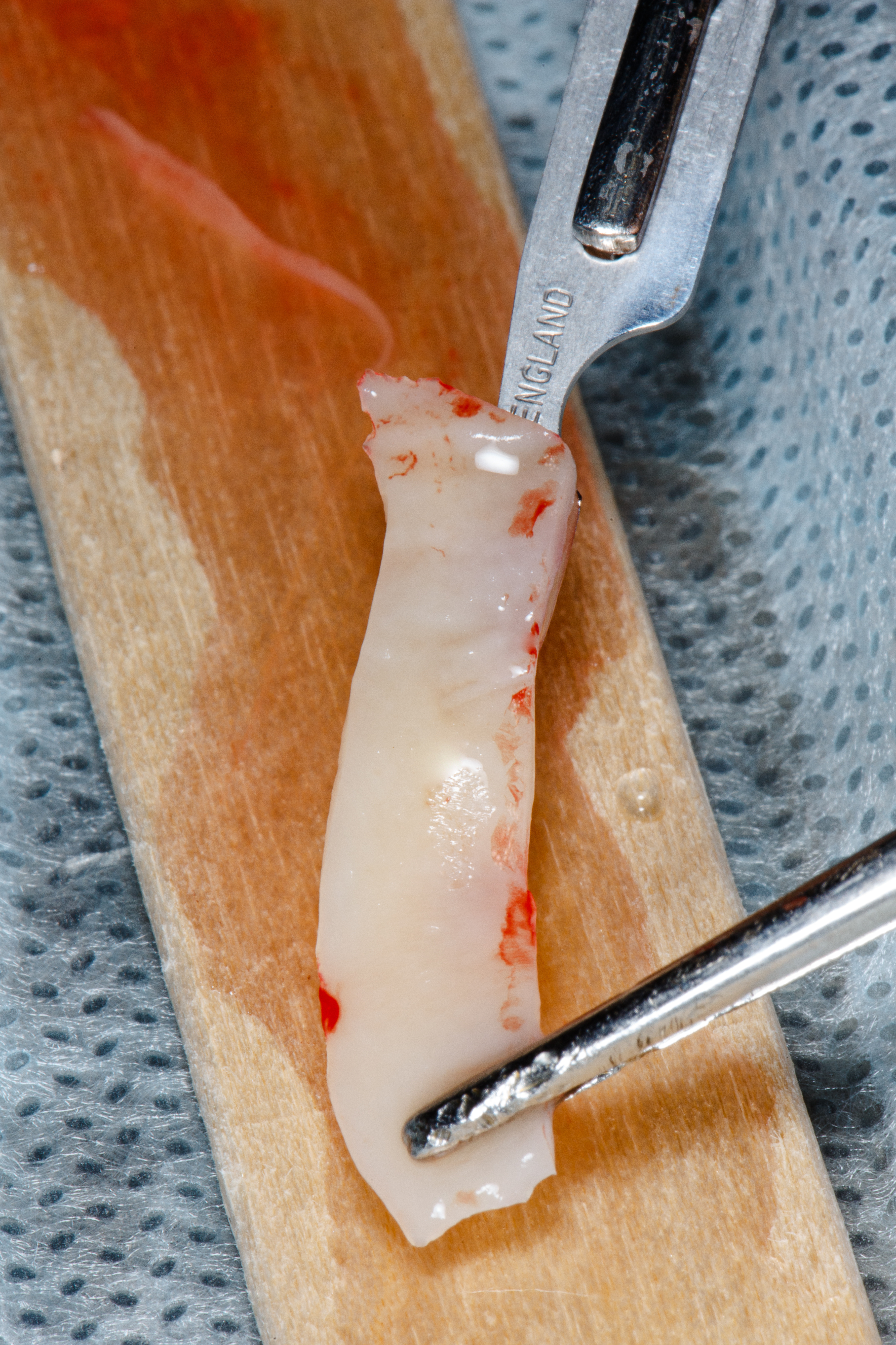 long flap soft tissue graft for implantation in the gum